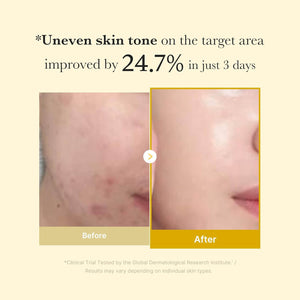 Kojic Acid Turmeric Night Wrapping Mask ℗ zambeel